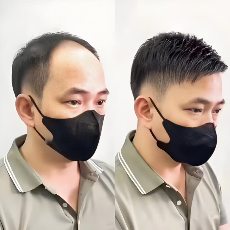 Men's wig