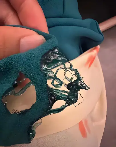 Example image 2 of substandard clothing quality